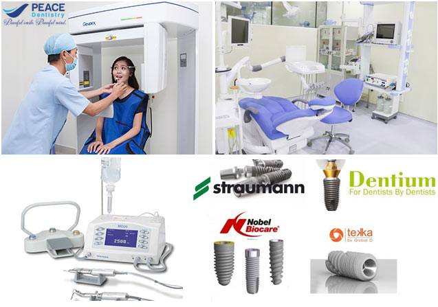 4 lưu ý thiết thực cho Kiều Bào khi trồng răng Implant ở Việt Nam - 4