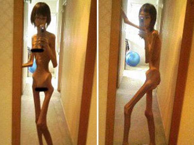 Thế giới - Nhật Bản: Cô gái gầy khủng khiếp vì ông nội bạo hành