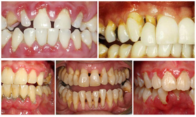Răng đẹp tự nhiên, tài lộc vô biên, đẹp không tốn tiền! - 3