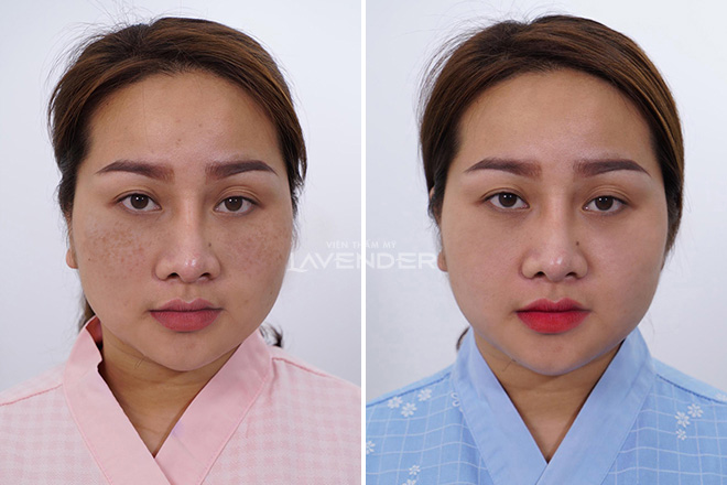 Trải nghiệm miễn phí hàng loạt dịch vụ làm đẹp cùng Ngọc Trinh - 6