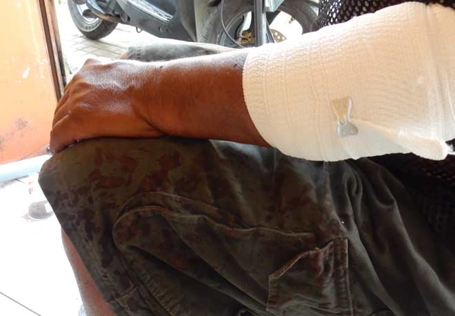 Bị chém trọng thương, U 70 tuổi vẫn tay không bắt tội phạm - 3