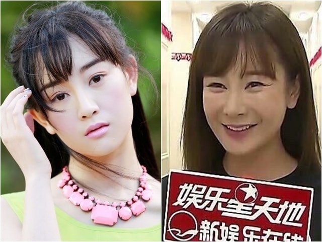 Thẩm mỹ viện - Nhan sắc tàn tạ của sao "Thiên long bát bộ" bị tố giật chồng