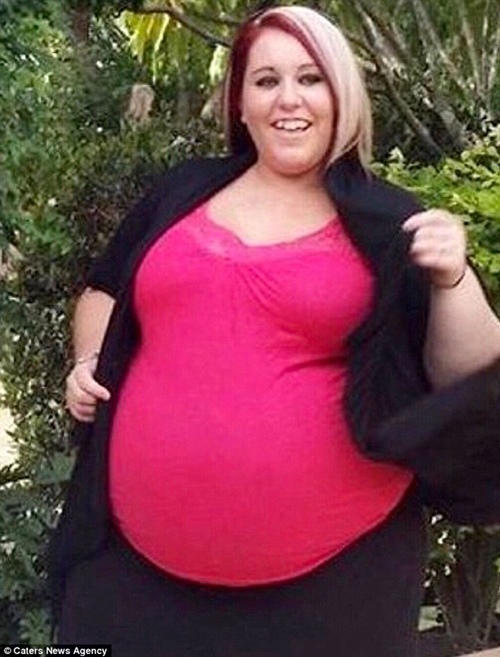 Người phụ nữ khổng lồ giảm cả tạ thịt sau chuyến bay kinh hoàng - 1