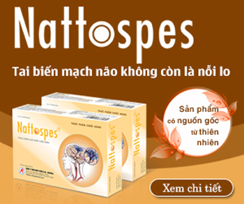 Choáng ngất – “đứng hình” khi biết mình có nguy cơ đột quỵ não - 3