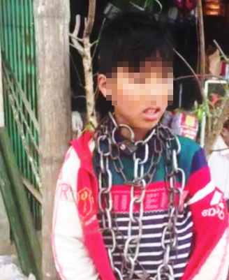 Sự thật về clip cháu bé bị “xích cổ” ở Thanh Hóa - 1