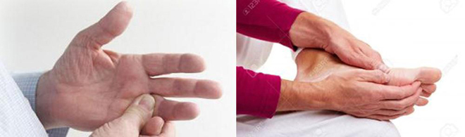 Cách giảm tê bì chân tay do đái tháo đường, tránh nguy cơ dẫn đến tàn phế - 1