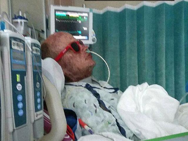 Sức khỏe đời sống - Người đàn ông trở thành xác sống sau khi dùng kháng sinh