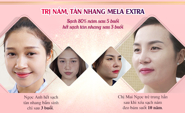 Đăng kí càng sớm, ưu đãi càng lớn các dịch vụ làm đẹp 8/3 - 6