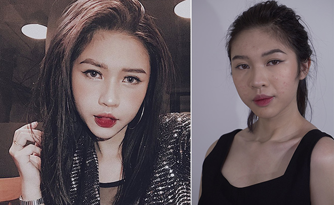 Mách chiêu “dẹp loạn” khi mụn nhọt đua nhau nổi dậy - 3