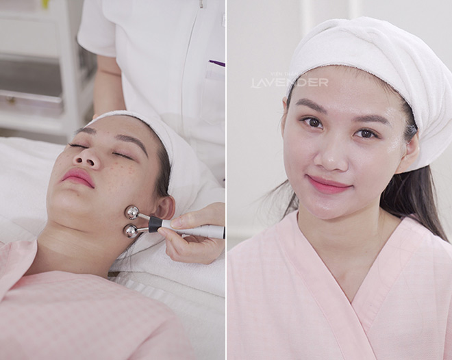 Mách chiêu “dẹp loạn” khi mụn nhọt đua nhau nổi dậy - 5