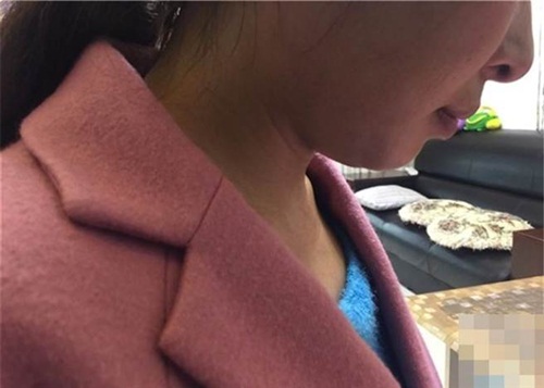 Cô gái suýt liệt nửa người vì bị bạn chú rể bóp cổ - 2