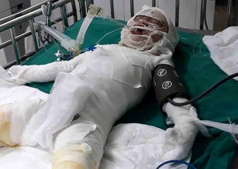 Thương tâm: Bé gái tử vong do ngã vào hố vôi - 1