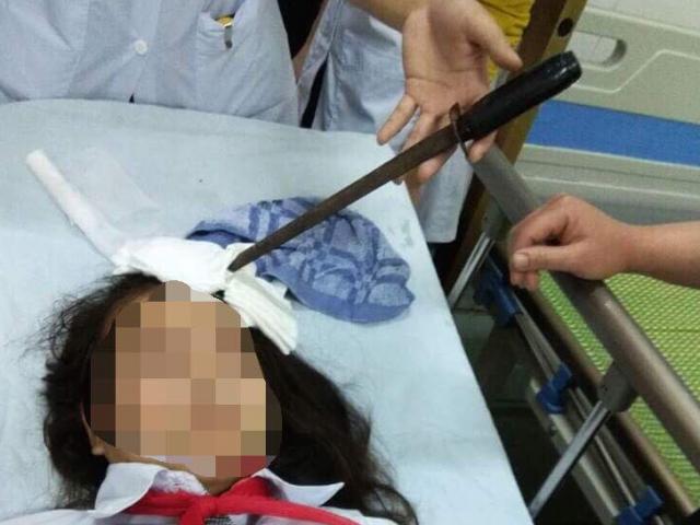 Tin tức trong ngày - Nóng 24h qua: Nữ sinh nhập viện với cây dao cắm thẳng trên trán