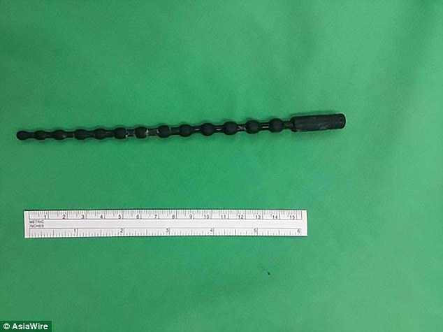 Đài Loan: Bị kẹt đồ chơi tình dục dài 20cm trong bàng quang - 1