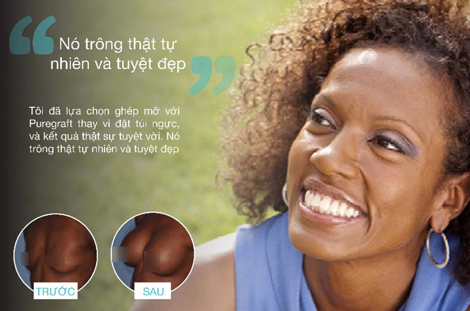 2018: Thẩm mỹ an toàn sẽ thay thế chất làm đầy bằng mỡ tự thân? - 3