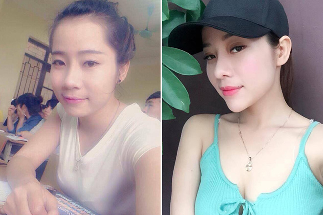 Khi giới trẻ đổ xô phẫu thuật thẩm mỹ đầu năm để "đổi vận" - 6