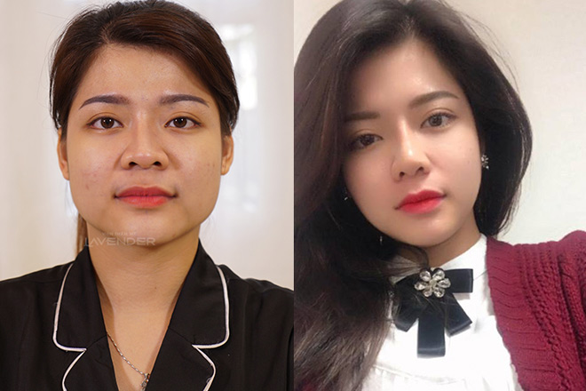 Khi giới trẻ đổ xô phẫu thuật thẩm mỹ đầu năm để "đổi vận" - 7