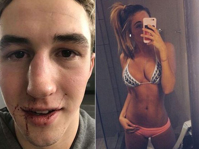 Bạn trẻ - Cuộc sống - Đòi chia tay, chàng trai bị bạn gái ‘mình dây’ đấm vỡ mũi