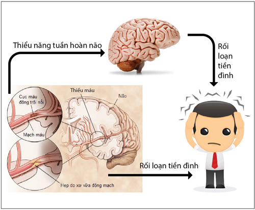 Chỉ 10 nghìn/ngày đánh bay hoa mắt, chóng mặt, đau đầu - 2