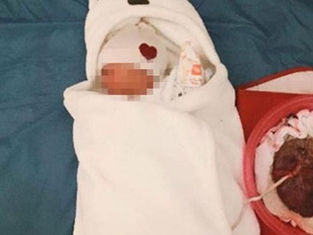 Sức khỏe đời sống - Những biến chứng cực kỳ nguy hiểm khi sinh con "thuận tự nhiên"