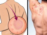 Sức khỏe đời sống - Biết những hậu quả “rợn người” này, ai còn lười tắm nhất định phải bỏ ngay lập tức