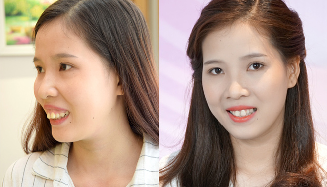 Từ cô gái xấu xí đến danh xưng “hot girl” - 3