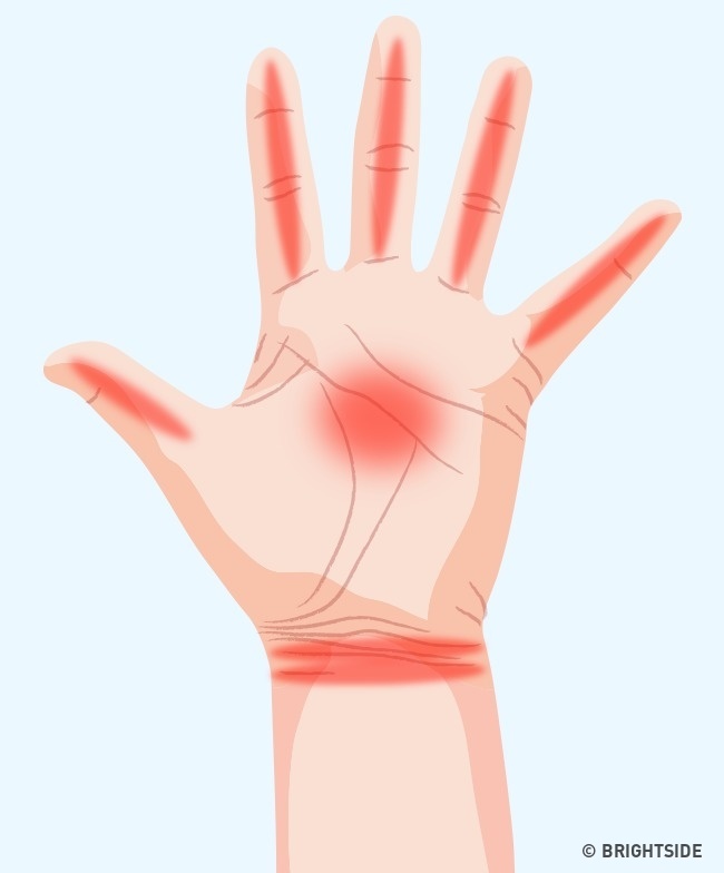 Bàn tay xuất hiện 7 dấu hiệu sau chứng tỏ cơ thể đang có bệnh “giấu mặt” - 1