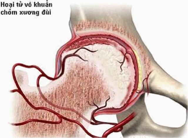 Căn bệnh đang trẻ hóa và gặp 80% ở nam giới - 1