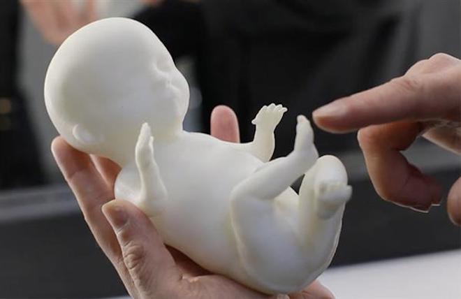 Công nghệ in 3D có thể "sao chép" thai nhi như thật - 2