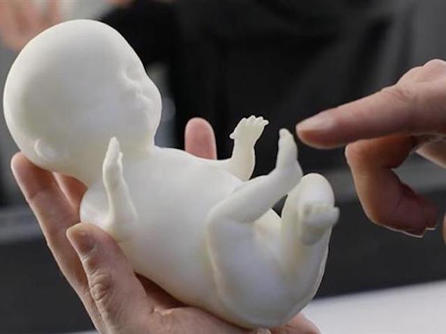 Công nghệ thông tin - Công nghệ in 3D có thể "sao chép" thai nhi như thật