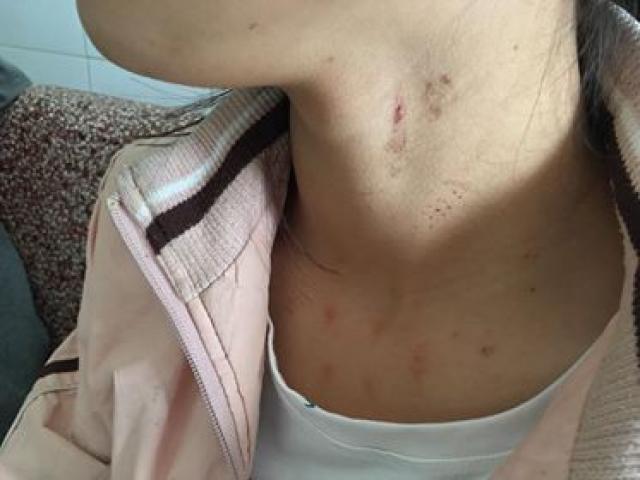 Pháp luật - Vụ tố nữ sinh lớp 10 bị cưỡng hiếp: Vì sao gia đình trình báo muộn?