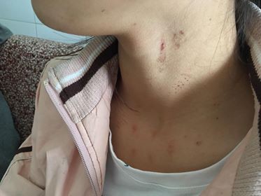 Vụ tố nữ sinh lớp 10 bị cưỡng hiếp: Vì sao gia đình trình báo muộn? - 1