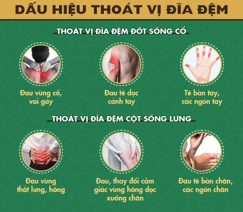 Hỗ trợ điều trị thoát vị đĩa đệm bằng Đông y: Xua tan nỗi lo biến chứng! - 1