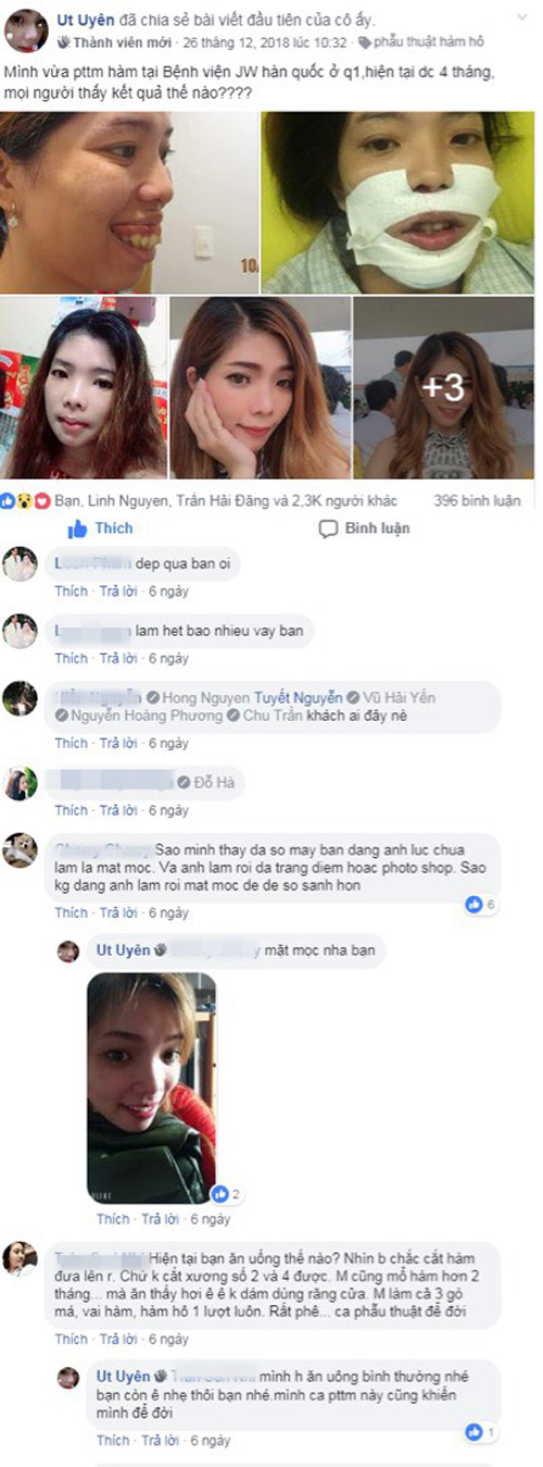 “Hotgirl hở lợi” bỗng nổi tiếng sau 1 đêm nhờ công khai ảnh phẫu thuật - 1