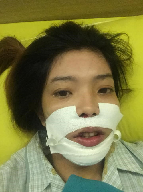 “Hotgirl hở lợi” bỗng nổi tiếng sau 1 đêm nhờ công khai ảnh phẫu thuật - 3