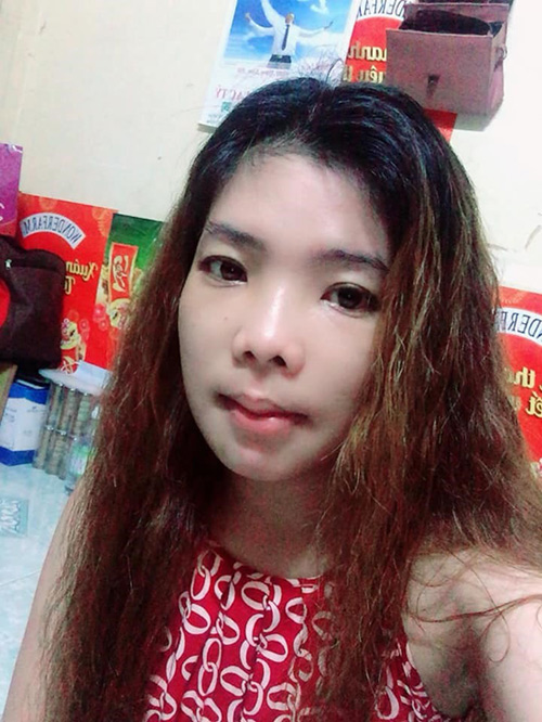 “Hotgirl hở lợi” bỗng nổi tiếng sau 1 đêm nhờ công khai ảnh phẫu thuật - 4