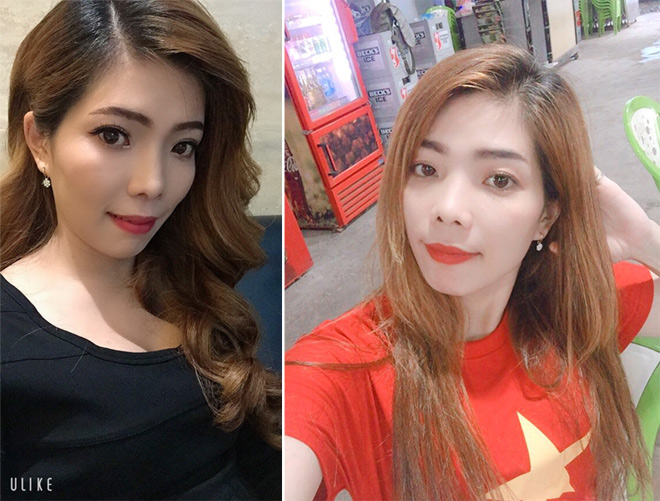 “Hotgirl hở lợi” bỗng nổi tiếng sau 1 đêm nhờ công khai ảnh phẫu thuật - 5