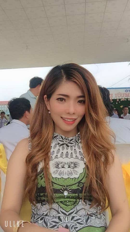 “Hotgirl hở lợi” bỗng nổi tiếng sau 1 đêm nhờ công khai ảnh phẫu thuật - 6