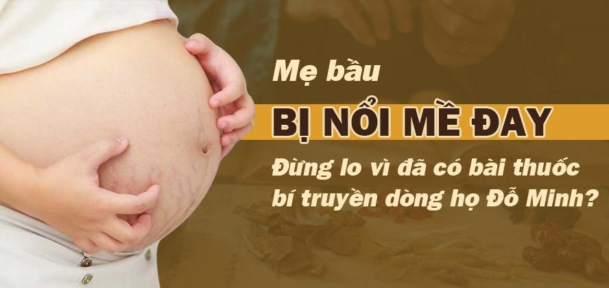 Nổi mề đay khi mang thai – mẹ bầu hết lo vì có bài thuốc Nam trị bệnh hiệu quả - 1