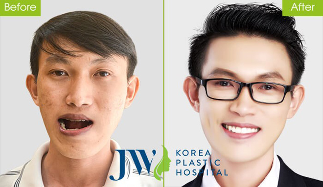 JW đứng top 1 bệnh viện thẩm mỹ uy tín chất lượng năm 2018 - 4