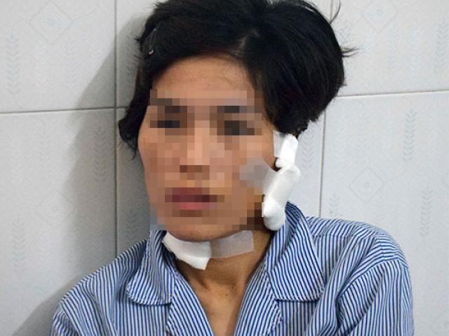 Pháp luật - Đã ly hôn vẫn hành hạ, đánh đập dã man vợ cũ