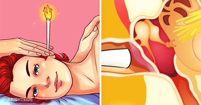 9 mẹo chữa bệnh cực kỳ nguy hiểm nhưng mọi người vẫn làm hằng ngày - 8