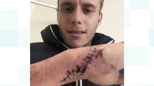 Chàng trai “thân tàn ma dại” vì bị bạn gái bạo hành - 2