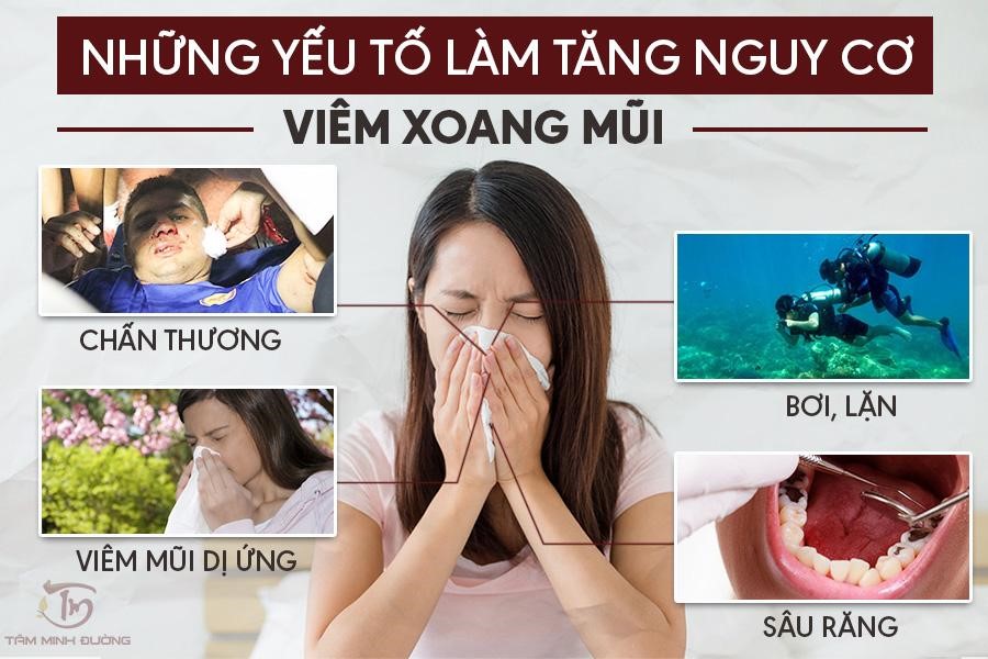 Viêm xoang: nguyên nhân, triệu chứng và cách chữa bệnh bằng bài thuốc dân gian - 2