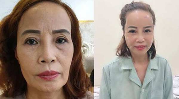 cô dâu 62 tuổi, cô dâu Thu Sao, phẫu thuật thẩm mỹ