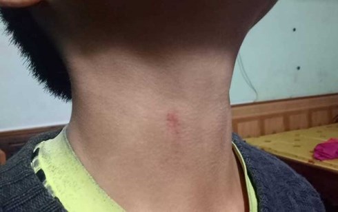 Thanh Hóa: Phụ huynh "tố" hiệu trưởng bóp cổ học sinh vì... hát trong lớp - 1