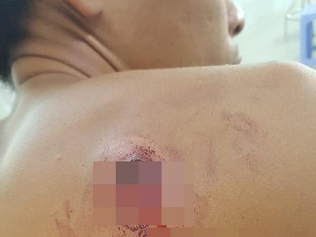 Công an thông tin vụ ”người dân đứng xem đá gà bị bắn” ở Trà Vinh
