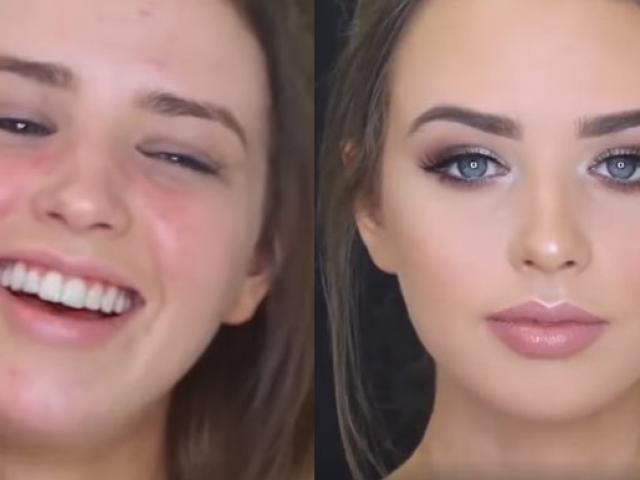 Làm đẹp - Cô gái mặt mụn xinh như tiên sau vài phút "tút tát"