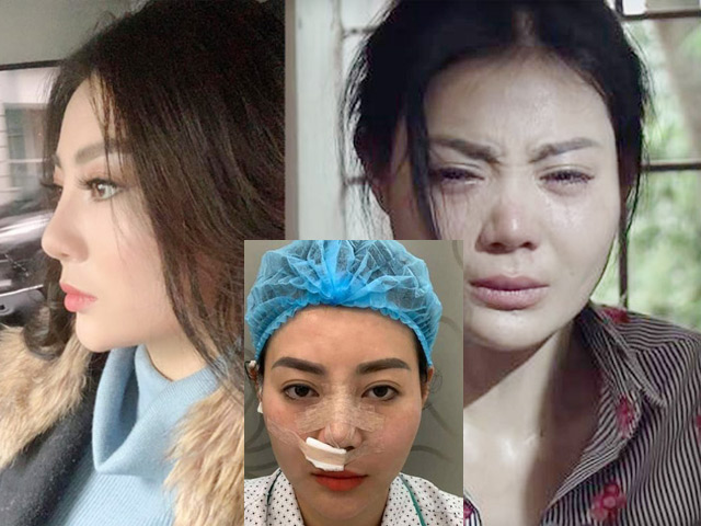 Làm đẹp - Lộ ảnh "Lan cave" Thanh Hương sửa mũi sau phim Quỳnh búp bê