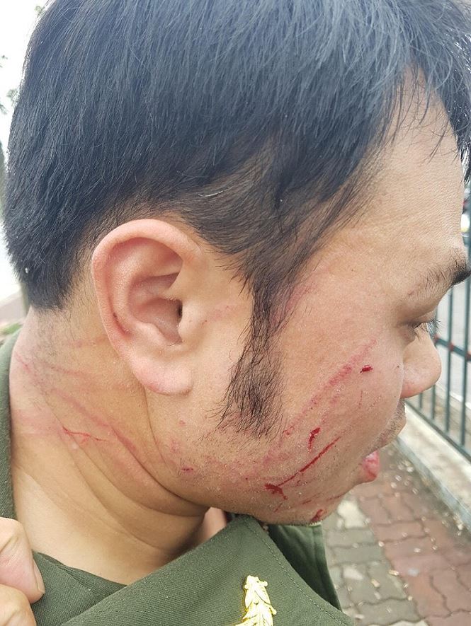 Đề nghị khởi tố ‘cò’ taxi đánh nhân viên sân bay Nội Bài gãy răng - 1
